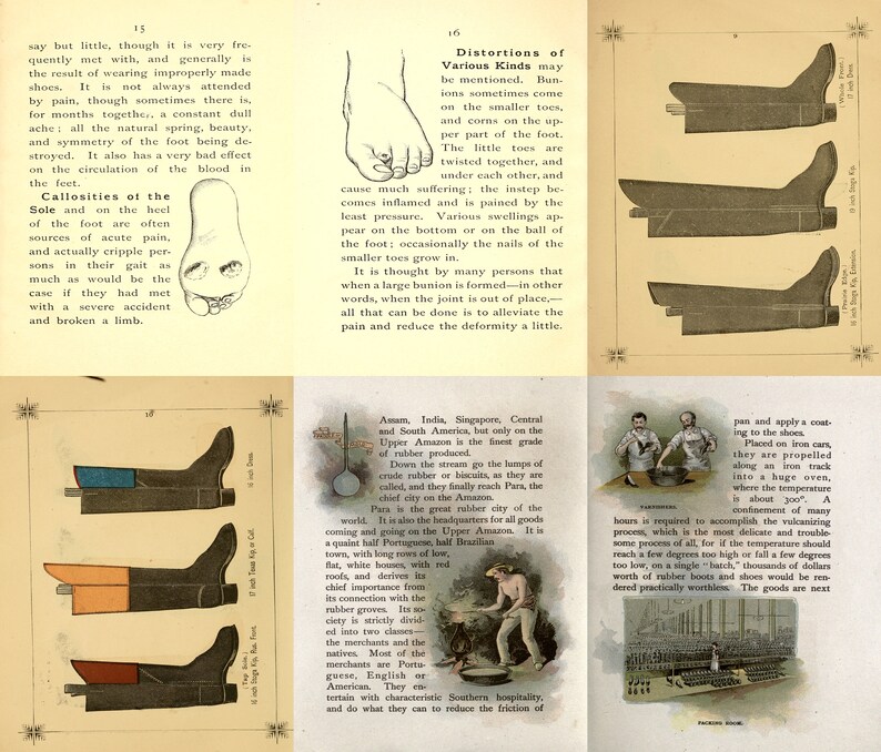 May include: An illustration of a foot with a bunion, a common foot deformity. The illustration shows the foot from the side, with the bunion on the big toe. The text below the illustration explains that bunions are often caused by wearing improperly fitted shoes.