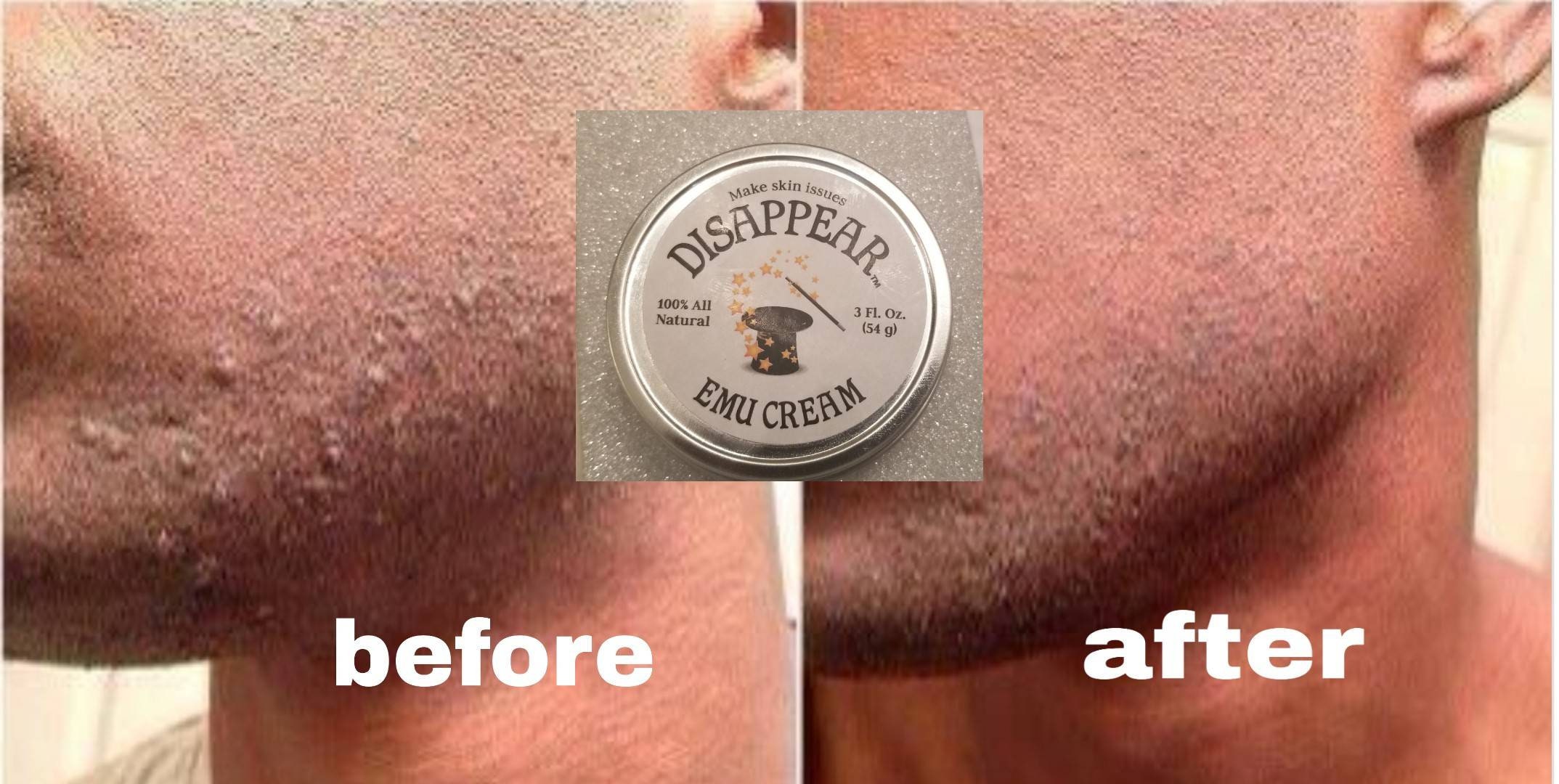 Aftershave cream Disappear emu cream . Etsy