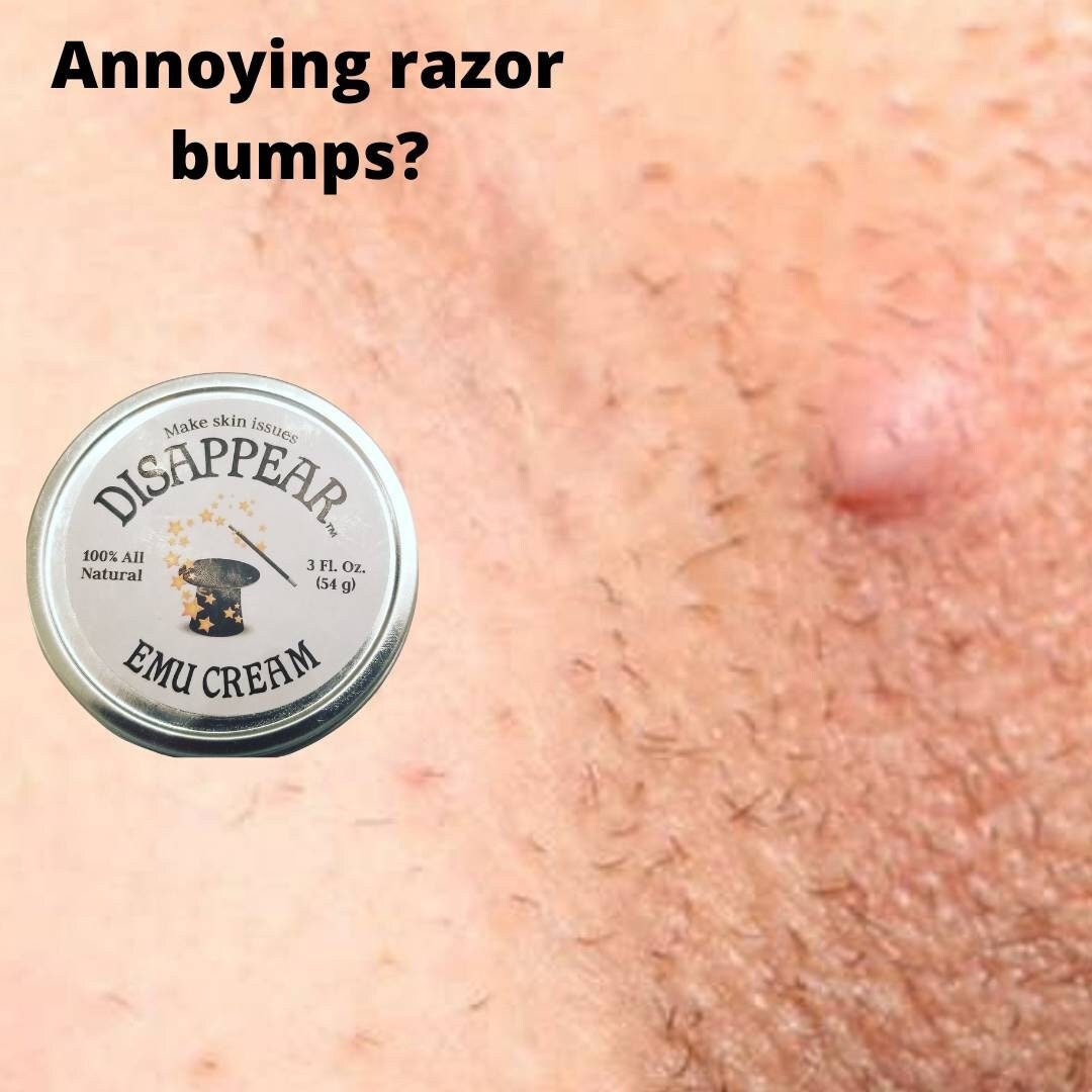 Annoying Razor Bumps on Your Private Area Our Emu Cream Can - Etsy Denmark Annoying Razor Bumps on Your Private Area Our Emu Cream Can - Etsy Denmark
