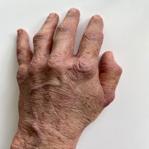 May include: Close-up of an elderly person's hand with visible veins and wrinkles. The hand is pale with a slightly reddish hue and has several brown spots.