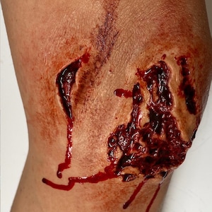 K&ouml;nnte beinhalten: Nahaufnahme einer blutigen, offenen Wunde am Knie einer Person. Die Wunde ist tief und klafft offen, mit Blut, das die Wade heruntertropft.