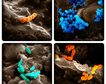 Bacteria EM 1
