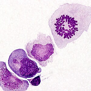 Mitotic Figure