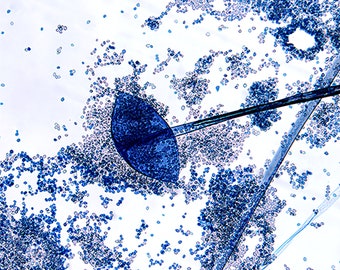 Rhizopus