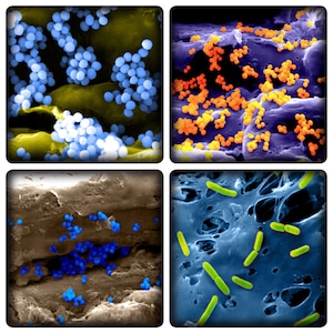 May include: A composite image of four microscopic views. The top left shows blue spherical structures on a yellow surface. The top right displays orange spheres. The bottom left shows blue spheres on a brown surface. The bottom right shows green rod-shaped structures.
