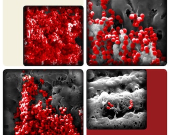 Bacteria EM 3
