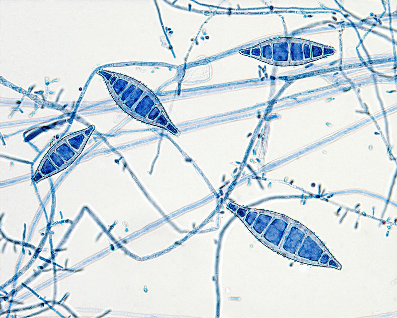 Microsporum canis image 1