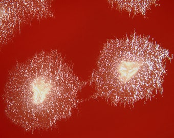 Clostridium sporogenes, Blood Agar Plate
