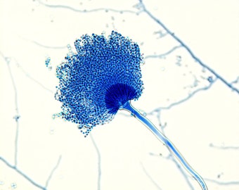 Aspergillus, #1