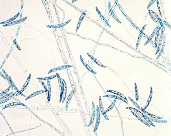 Fusarium