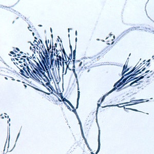 Uric Acid Crystals, Polarized Light - Etsy