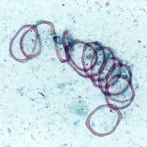 Artifact, Trichrome Stain