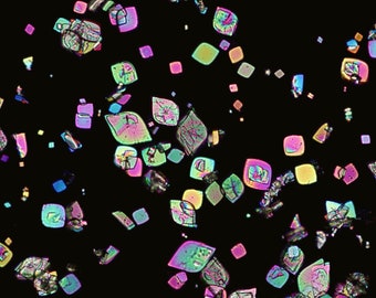 Uric Acid Crystals, Darkfield