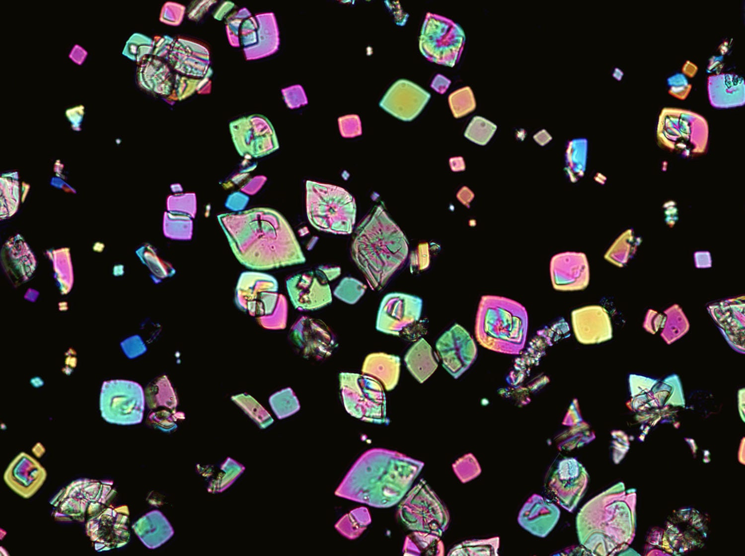 Microscopic image of Urinalysis. Abnormal urine exam. Uric acid crystals.  13675255 Stock Photo at Vecteezy, image size:1500x1119