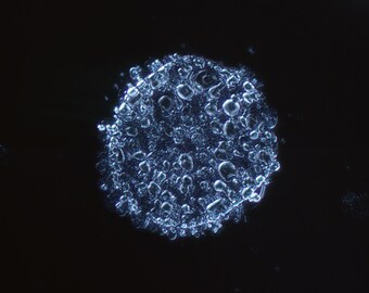 Oval Fat Bodies, Polarized Light
