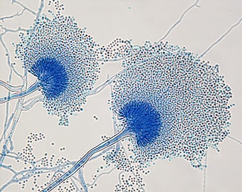 Aspergillus #2
