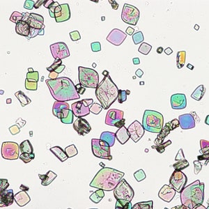 Uric Acid Crystals, Polarized Light