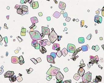 Uric Acid Crystals, Polarized Light