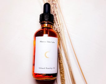 Rosehip OIl, Face Cleanser, Toner, Face Oil, Face Serum , Natural Face Serum, Vitamin C, Retinol, Anti-aging