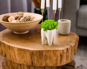 Moss tooth pot preserved moss Dentist gift  Tooth gypsum planter Home decor Dentist office sign Moss decor Orthodontist gift