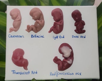 12 Week Gestational Fetus stores Memorial