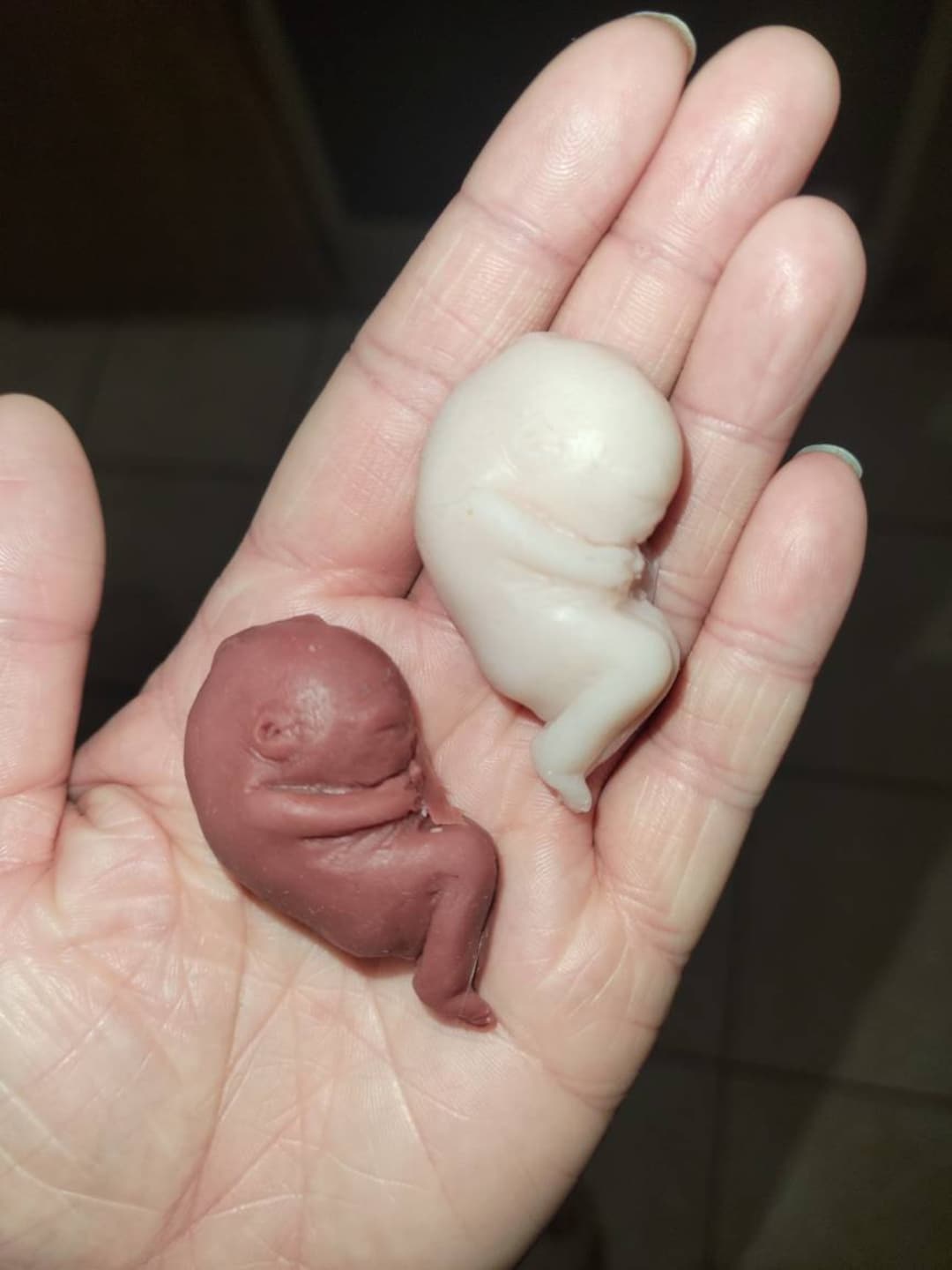 Fetus 12 Week Old Baby Development 2+ Hundred Fetus 12 Weeks