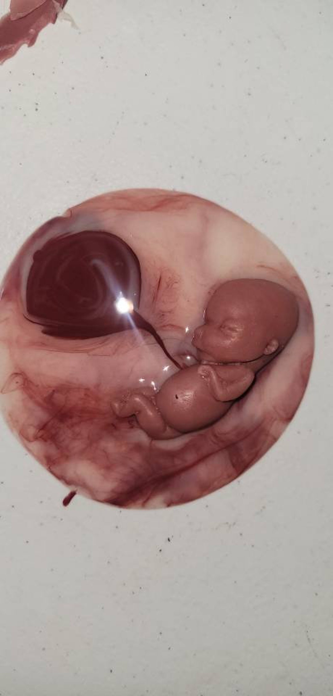 12 Week Gestational Fetus Silicone Memorial Baby Inside Silicone Womb With  Placenta Attached