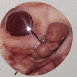 12 week gestational fetus silicone memorial baby inside silicone womb with placenta attached