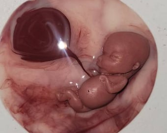 12 Week Gestational Fetus Silicone Memorial Baby Inside Silicone