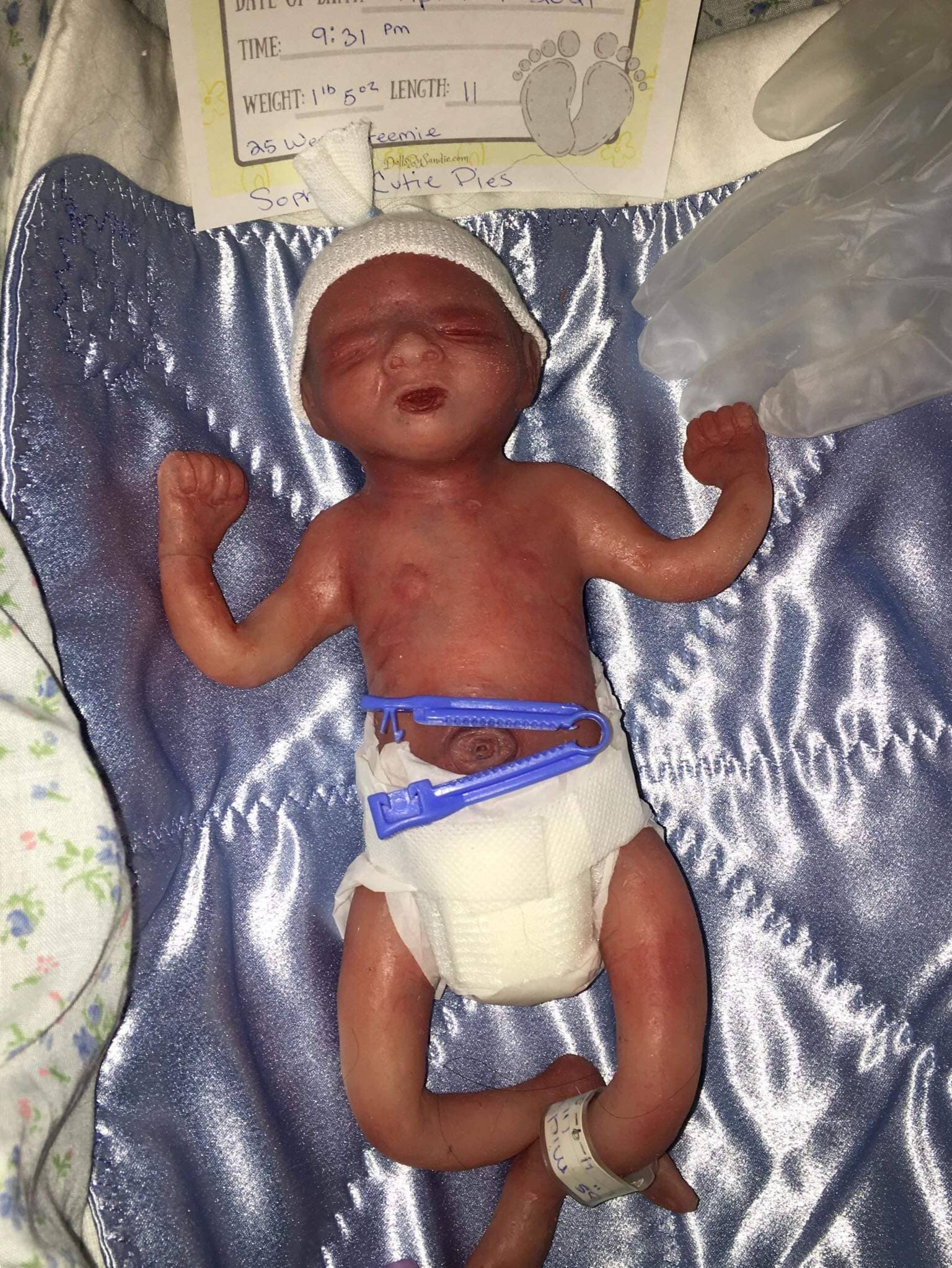 Full Body Silicone Baby 24 Week Gestation 11 Marvin - Etsy