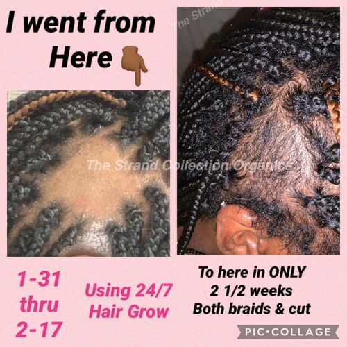 THE BEST Hair Oil for Hair Growth to Grow Hair for Men - Etsy THE BEST Hair Oil for Hair Growth to Grow Hair for Men - Etsy