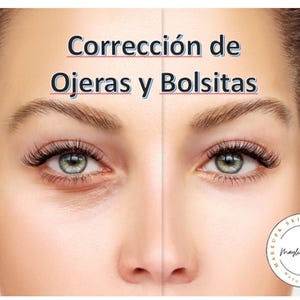 Puede incluir: Imagen que compara la apariencia de los ojos antes y después de un tratamiento de cuidado de la piel. El texto "Corrección de Ojeras y Bolsitas" se muestra encima de los ojos. La imagen también incluye un logotipo circular con texto.