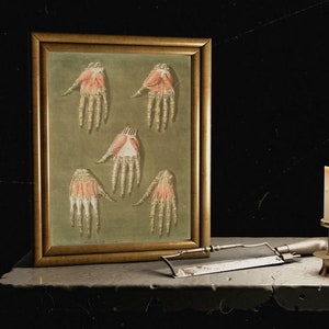Gothik, Handanatomie, Skelett, Halloween-Dekoration, Anatomische Illustrationen, Arnauld-Eloi Gautier-Dagoty, Kunstdruck 1800s, Knochen