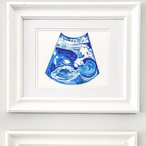 Hand painted portrait, Custom Sonogram painting, Sonogram art, Original Sonogram painting, Ultrasound painting, Custom Ultrasound art