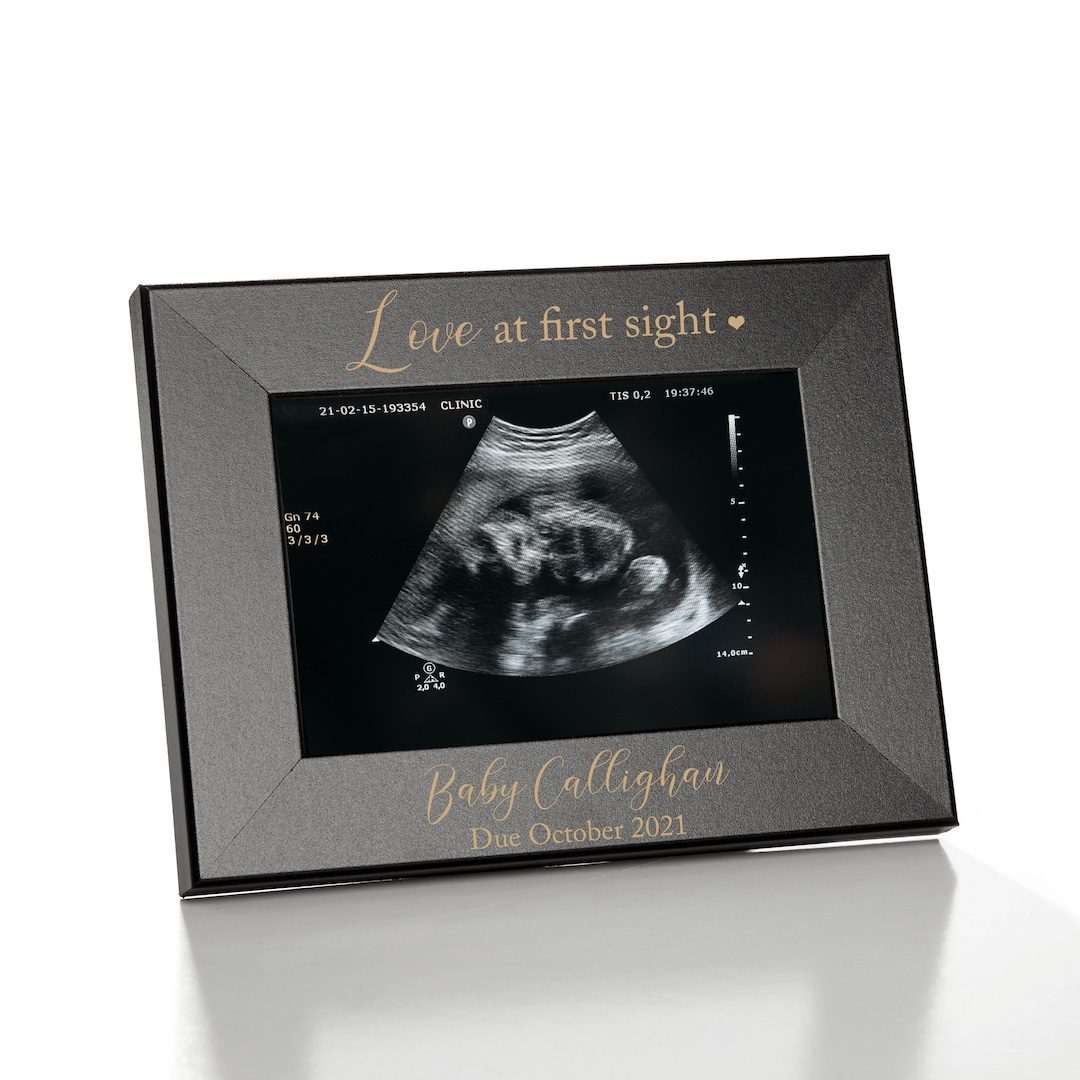 Sonogram Picture Frame Ultrasound Photo Frame Pregnancy Announcement