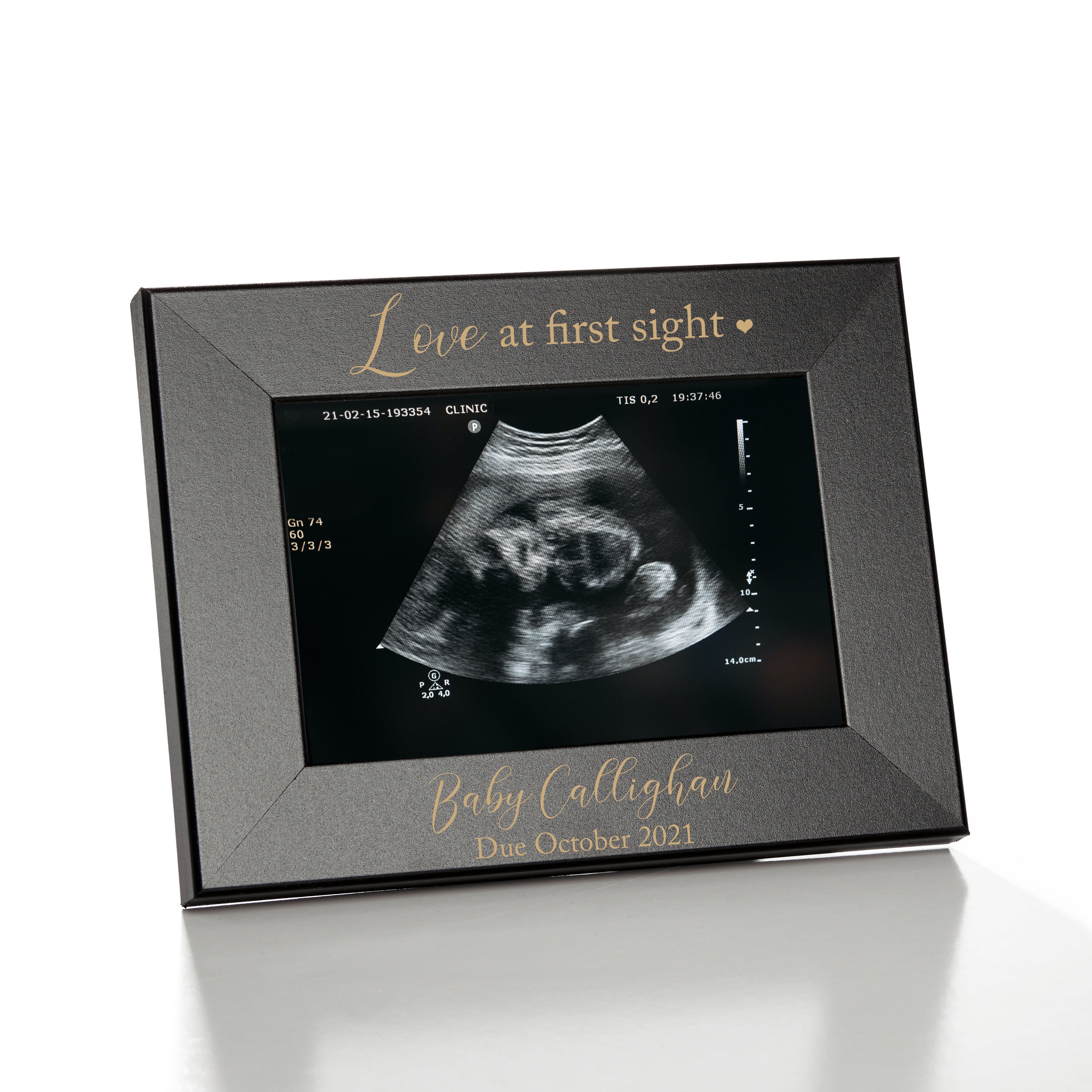 Cadre dimage Sonogram cadre photo à ultrasons Cadre photo dannonce