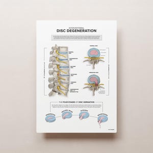 INTERVERTEBRAL DISC DEGENERATION