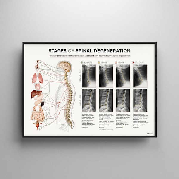 Spinal Degeneration '24 - X-RAY -  Cervical & Lumbar