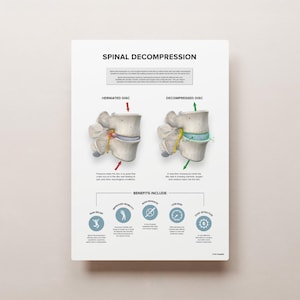 SPINAL DECOMPRESSION