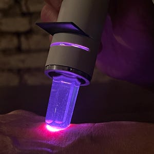 K&ouml;nnte beinhalten: Ein wei&szlig;es und silbernes Ger&auml;t mit einem violetten Licht, das von der Spitze abgegeben wird, wird auf der Haut verwendet.