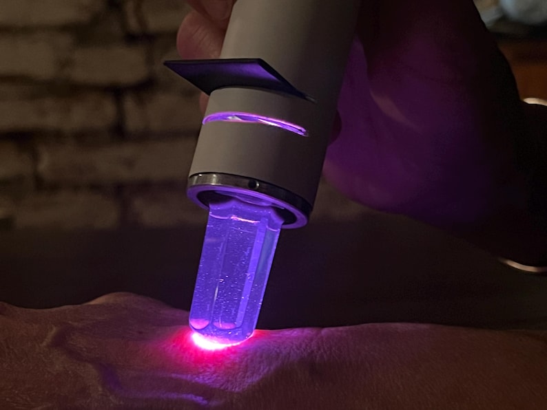 K&ouml;nnte beinhalten: Ein wei&szlig;es und silbernes Ger&auml;t mit einem violetten Licht, das von der Spitze abgegeben wird, wird auf der Haut verwendet.