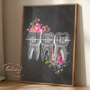 Braces Poster, Dental Wall Art, Tooth Anatomy Print, Dentist Gift, Dental Clinic Decor, Orthodontist Gift,  Stomatology Art, Dental Care