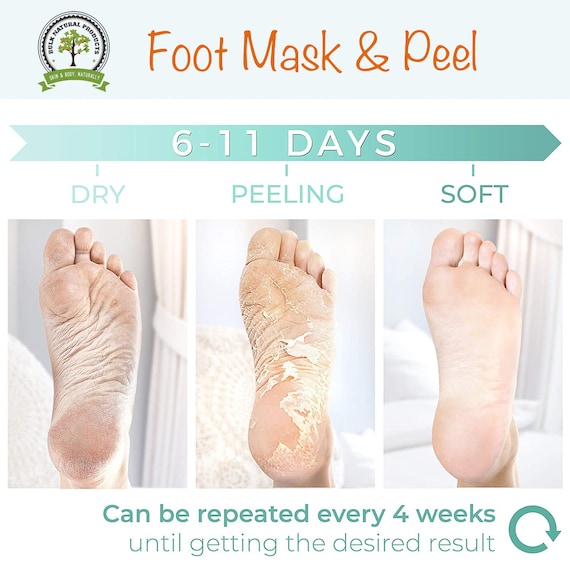 Why Are My Feet So Dry?, Natural Foot Peel