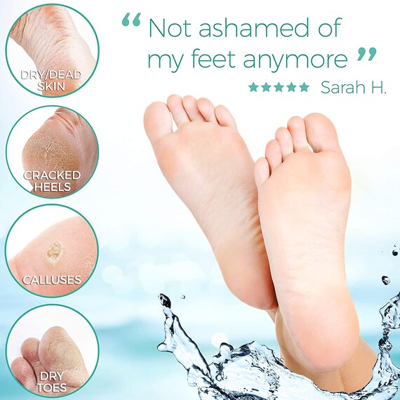 My Sweet Feet Foot Mask Foot Peel Etsy