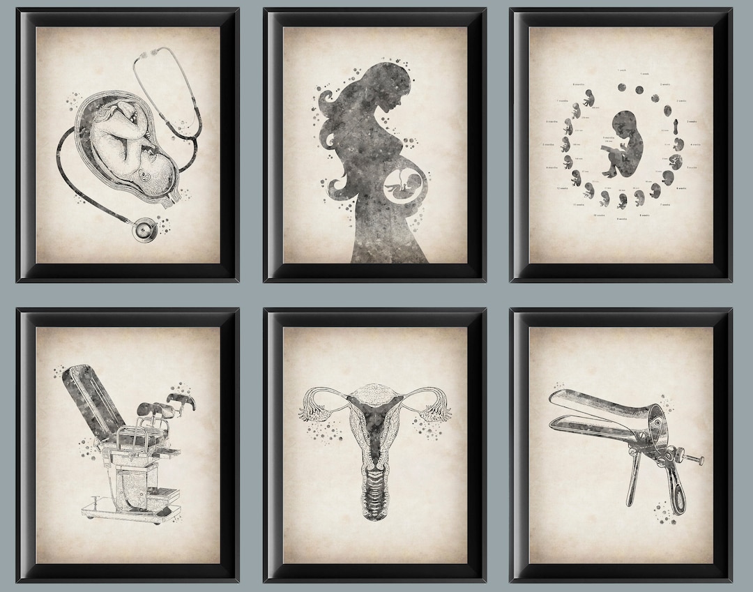 6 Vintage Obgyn Art Midwifery Art Pregnancy Art Prenantal Care Poster ...