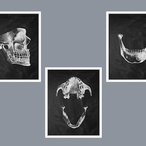 May include: Three black and white anatomical illustrations of a human skull, jawbone, and teeth on a black background.