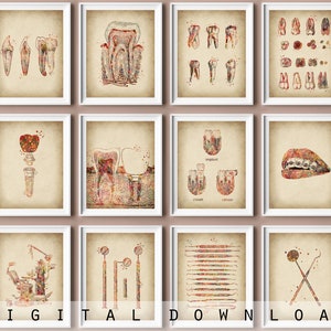 Set of 12 Dentist Office Decor Vintage Medical Art Doctor Tools Tooth Anatomy Teeth Braces Tooth Implant Antique Dentistry Poster Clinic Art