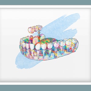 Dental Implant Art Dental Imlantology Art Dental Surgery Art Teeth and Implant Print Dentist Gift Orthodontist Gift Dental Clinic Wall Decor
