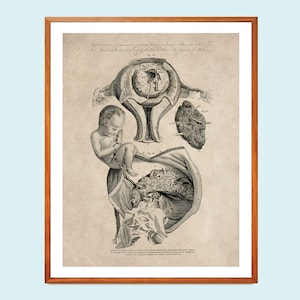 Arte vintage de ginecología, póster médico, impresión de feto, bebé en el útero, placenta, desarrollo fetal, arte de partera, anatomía femenina, póster de embarazo
