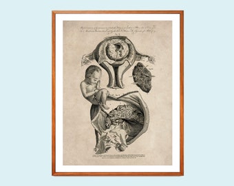 Vintage Fetal Development Print: OBGYN Medical Anatomy Poster